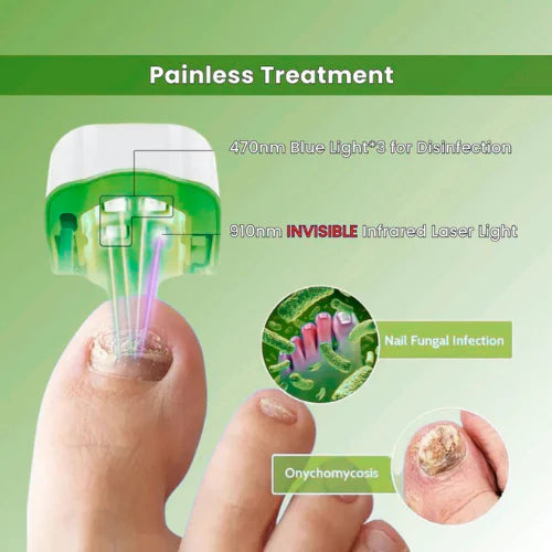 Fungiclear- Nail Fungus Laser