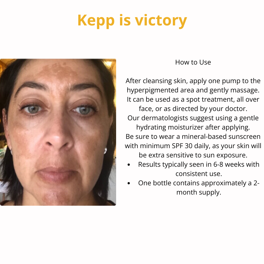 Muselee The Spot Cream