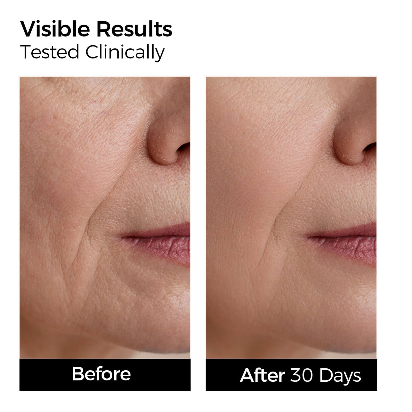 3% Hyaluronic Acid Deep Hydration