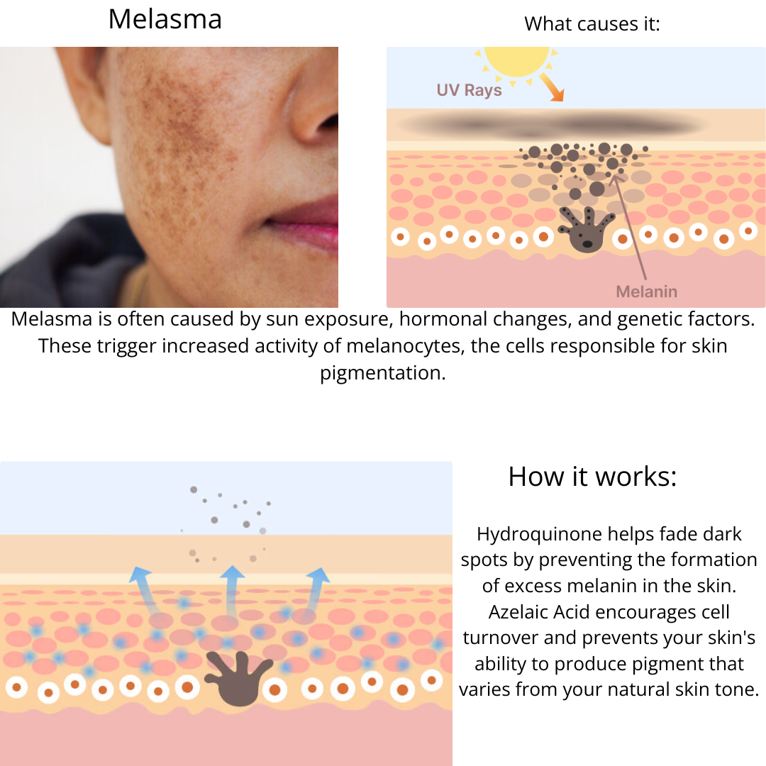 Muselee The Spot Cream
