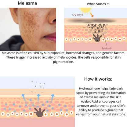 Muselee The Spot Cream
