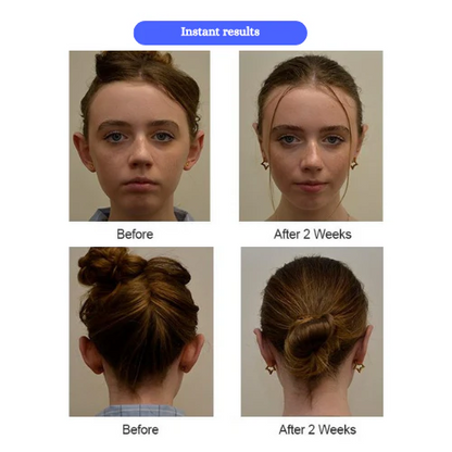 Ear Correctors