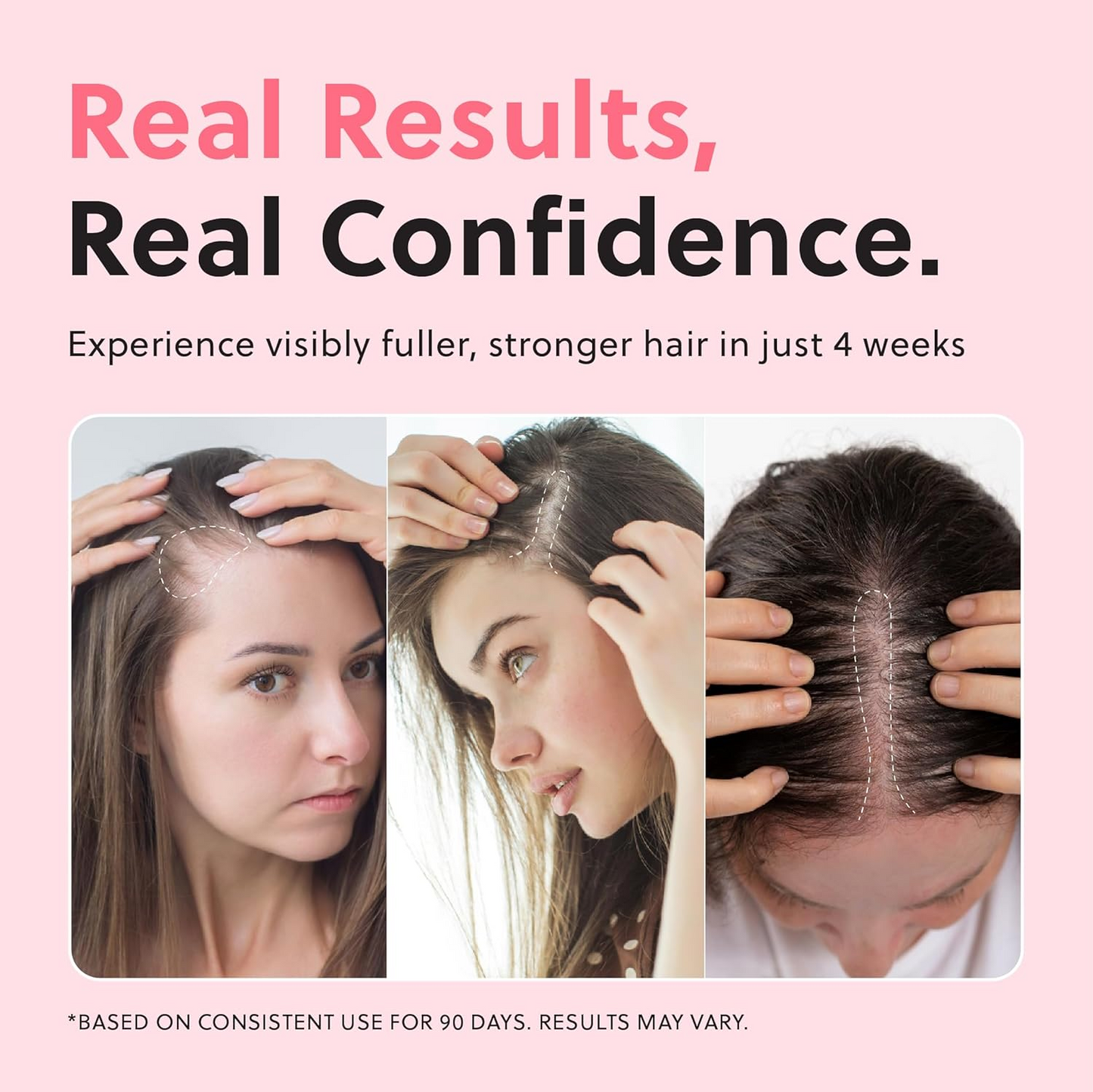 ForHair Advanced Hair Growth Serum