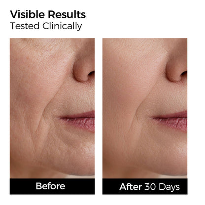 3% Hyaluronic Acid Deep Hydration